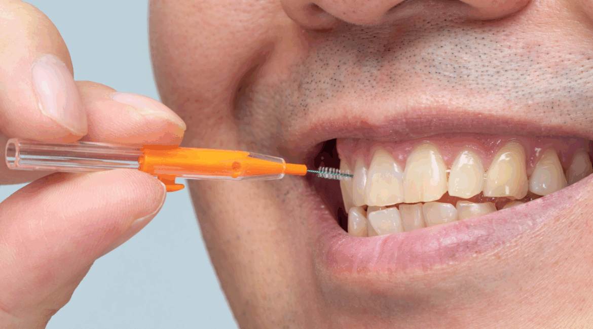 Affordable Cosmetic Dentistry: What Are My Options for Improving My Smile?