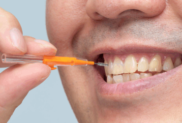 Affordable Cosmetic Dentistry: What Are My Options for Improving My Smile?