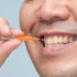 Affordable Cosmetic Dentistry: What Are My Options for Improving My Smile?