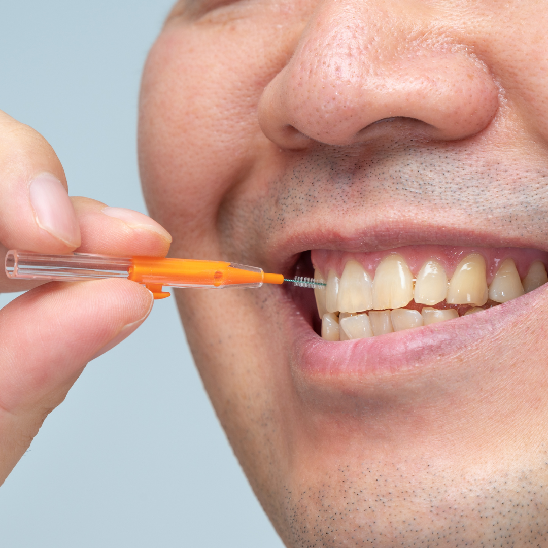Affordable Cosmetic Dentistry: What Are My Options for Improving My Smile?