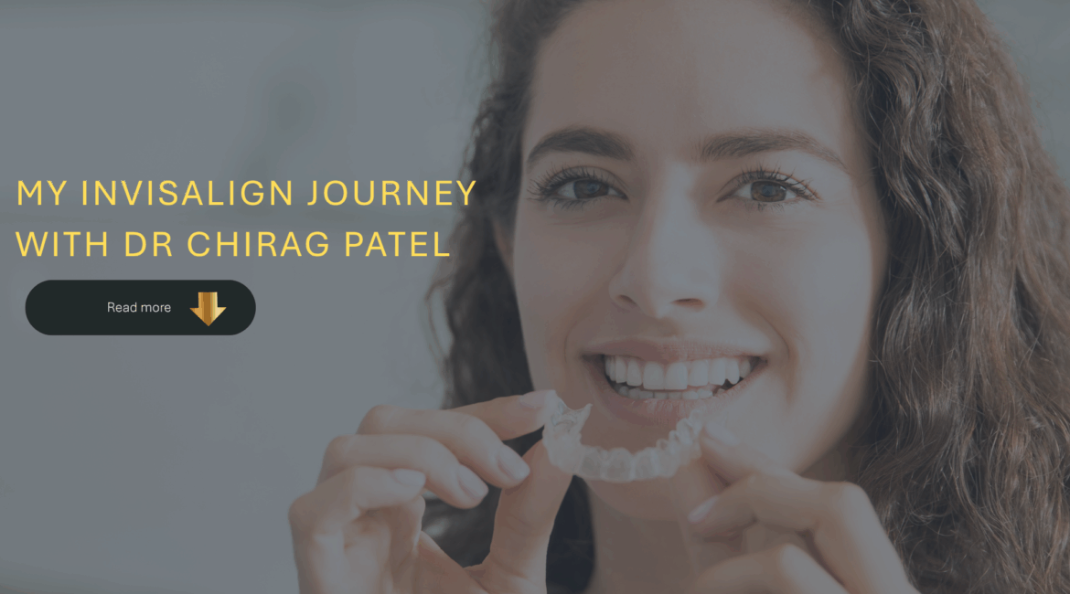 My Invisalign Journey with Dr Chirag Patel at Dental Elements